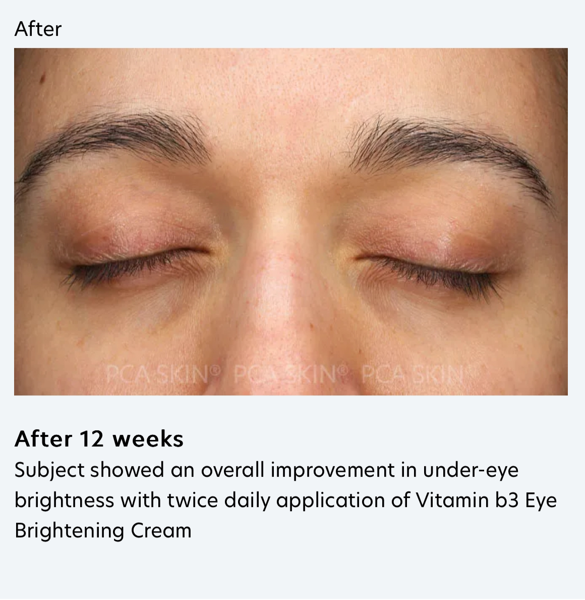 Vitamin B3 Eye Brightening Cream